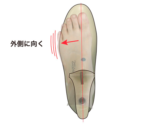 従来の木型